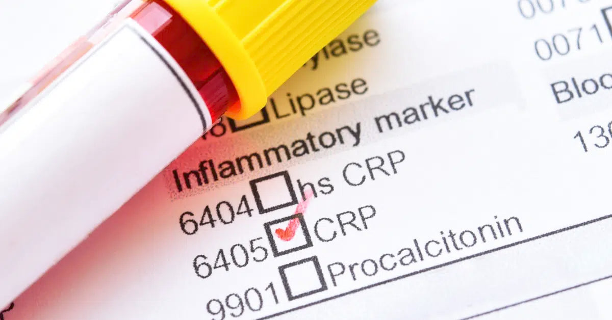 Understanding CRP Levels (Inflammation Markers)